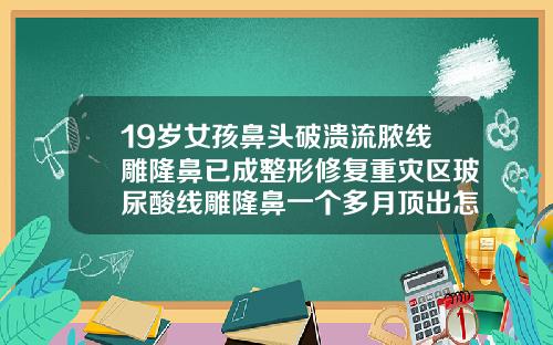 19岁女孩鼻头破溃流脓线雕隆鼻已成整形修复重灾区玻尿酸线雕隆鼻一个多月顶出怎么办