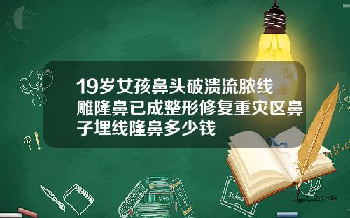 19岁女孩鼻头破溃流脓线雕隆鼻已成整形修复重灾区鼻子埋线隆鼻多少钱