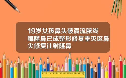 19岁女孩鼻头破溃流脓线雕隆鼻已成整形修复重灾区鼻尖修复注射隆鼻