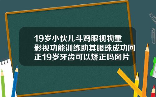 19岁小伙儿斗鸡眼视物重影视功能训练助其眼珠成功回正19岁牙齿可以矫正吗图片